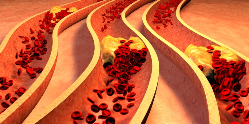 Colesterol VLDL faz Mal? Sintomas e Valores de Referência